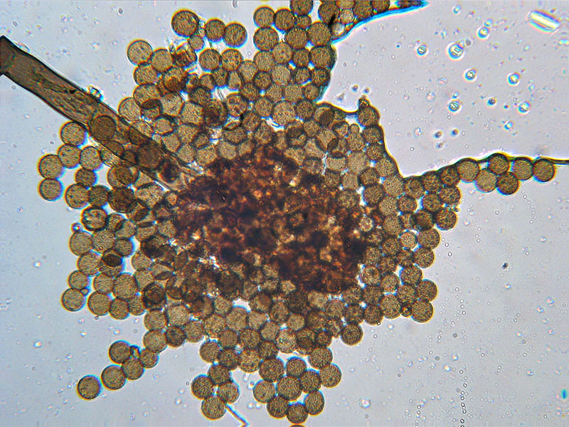 Echinostelium?